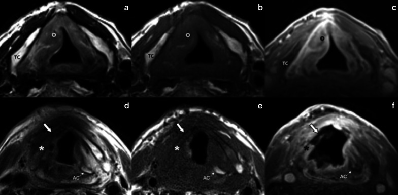 Fig. 11