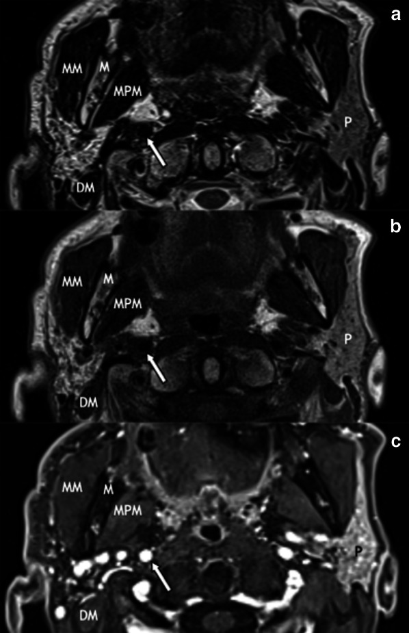 Fig. 8