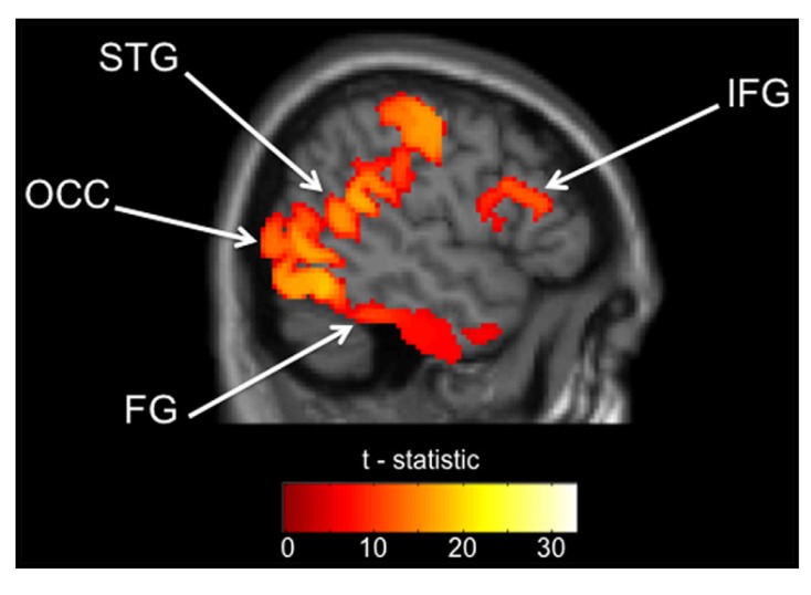 FIGURE 1