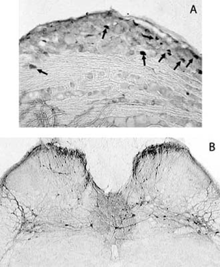 Fig. (2)