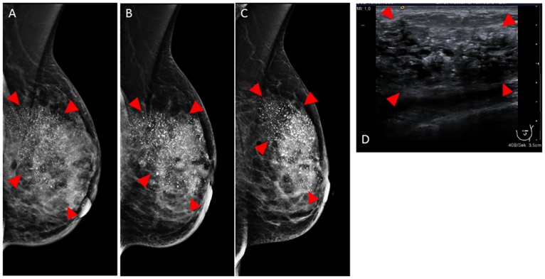 Fig 8