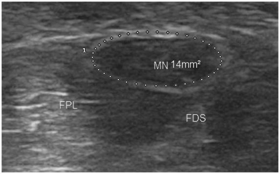 Figure 13.