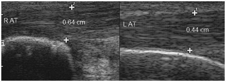 Figure 11.