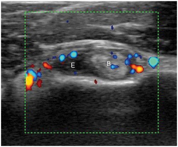 Figure 15.