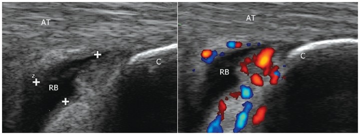 Figure 12.