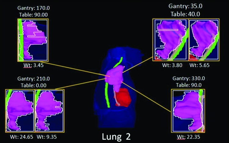 Figure 11