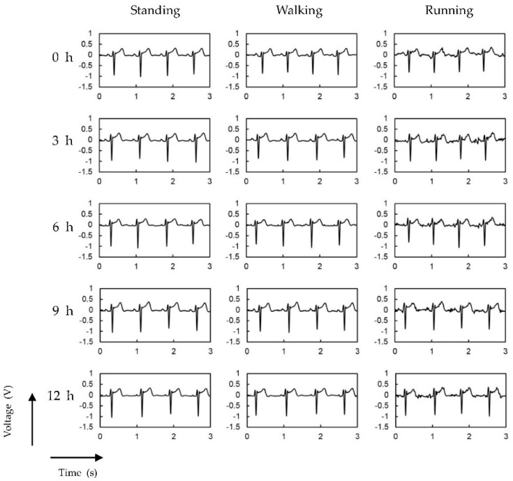 Figure 12