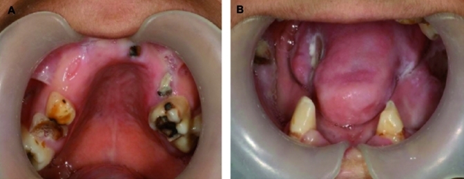 Fig. 1A and 1B