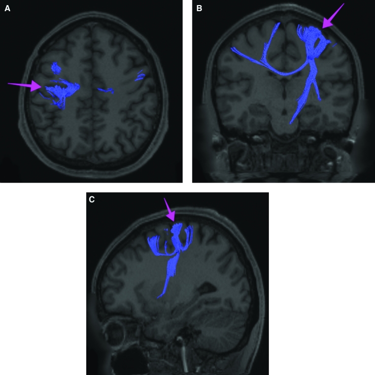 FIGURE 35.