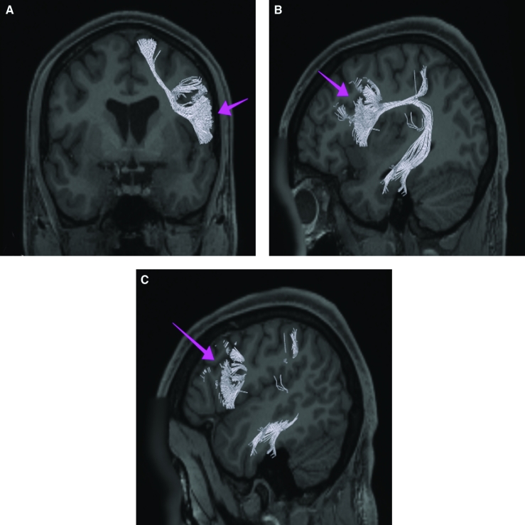 FIGURE 45.