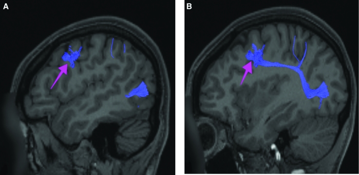 FIGURE 41.