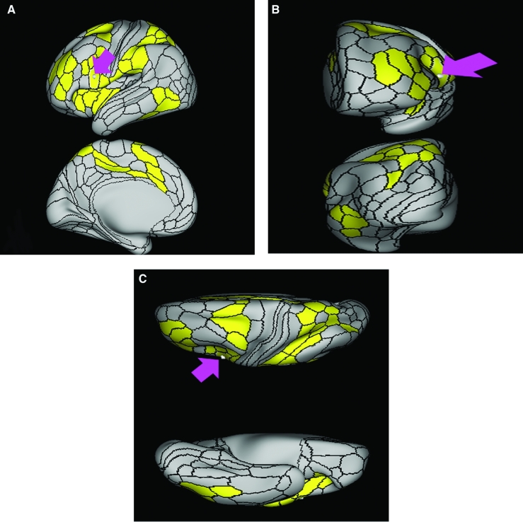 FIGURE 44.