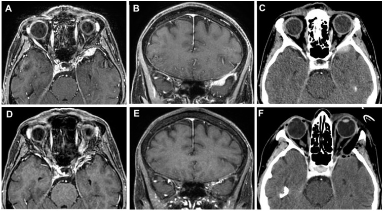 Figure 11