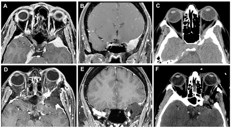 Figure 13