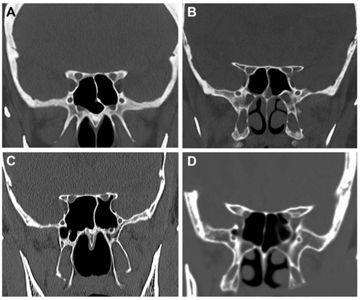 Figure 9