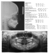 Fig. (2)
