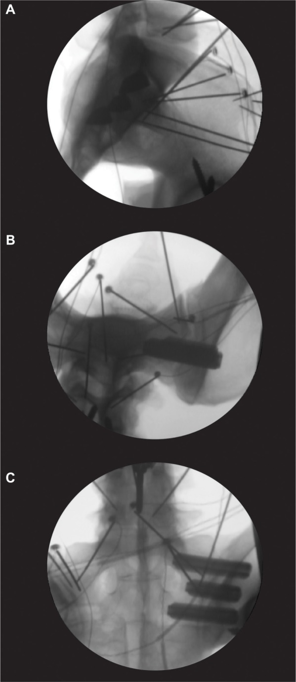 Figure 2