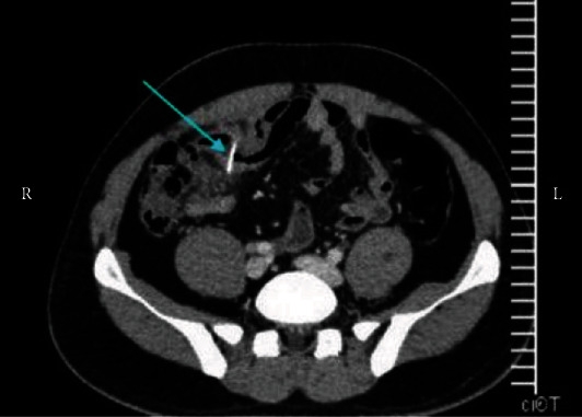 Figure 2