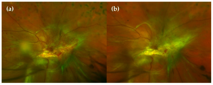 Figure 6