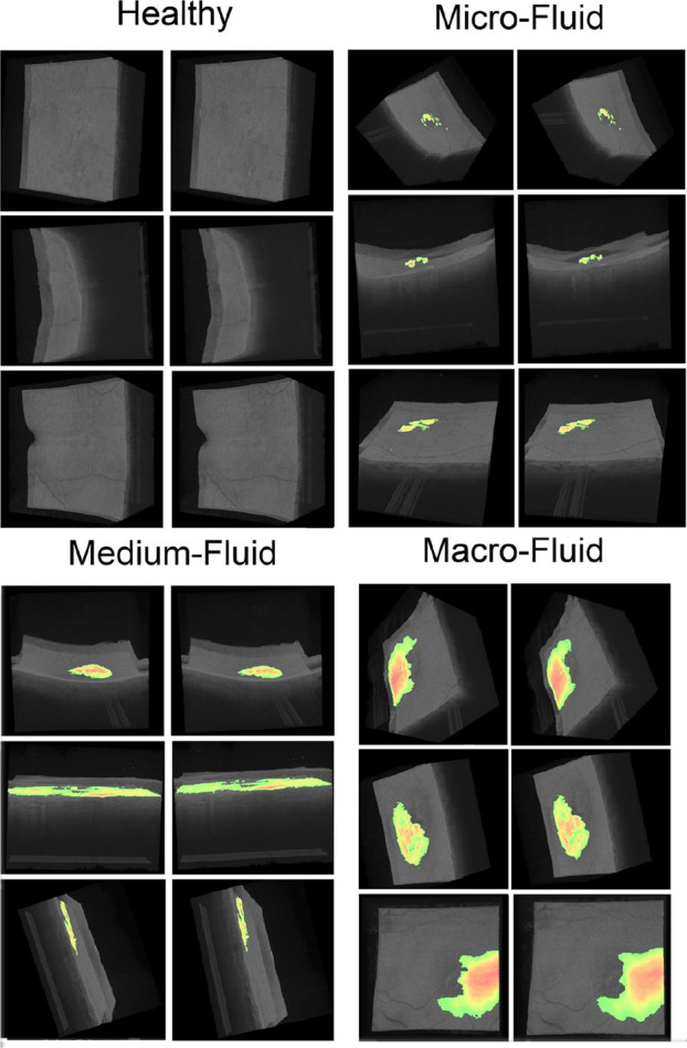 Fig. 11