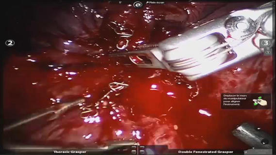 Video 2
