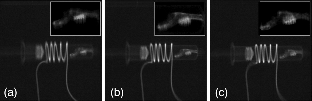 Figure 11