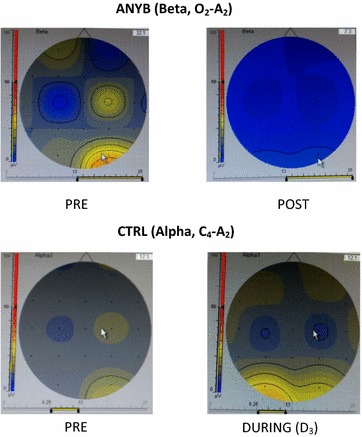 Fig. 3