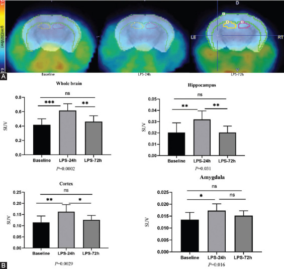 FIGURE 3