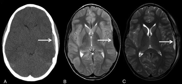 Fig 2.