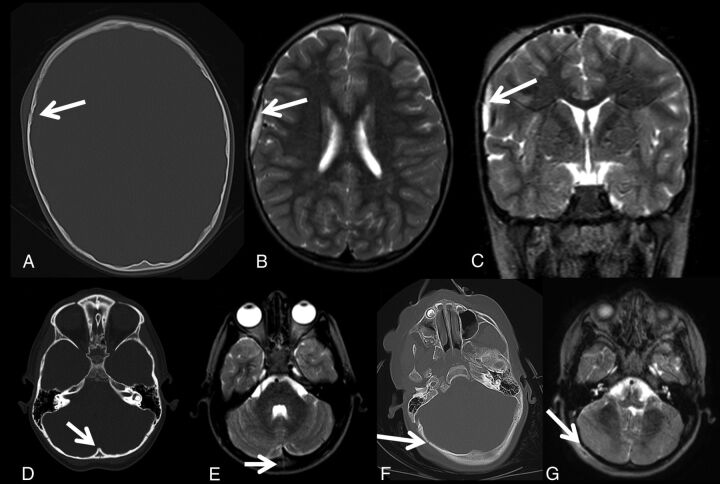 Fig 4.