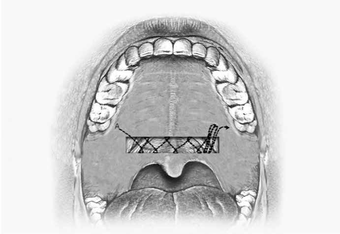 Fig. 3.