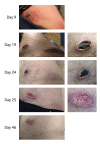 Fig 4