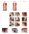 Fig 5
