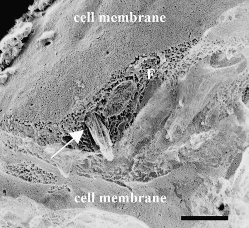 FIG. 12.