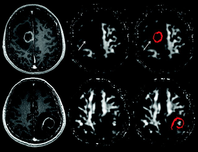 Fig 2.