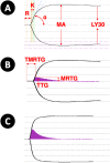 Fig. 1