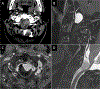 Figure 14: