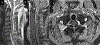 Figure 18: