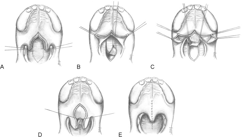 Fig. 4