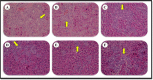 Legend Figure 1
