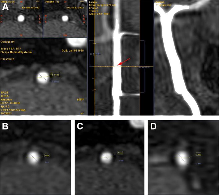 Fig. 3