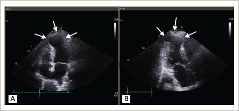 Figure 3: