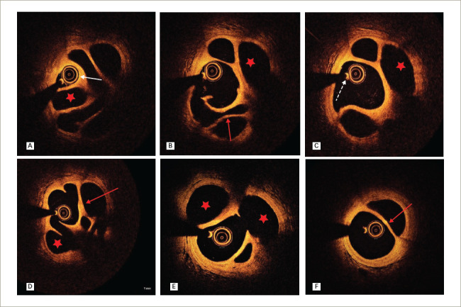 Figure 6: