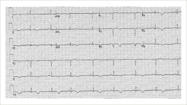 Figure 2: