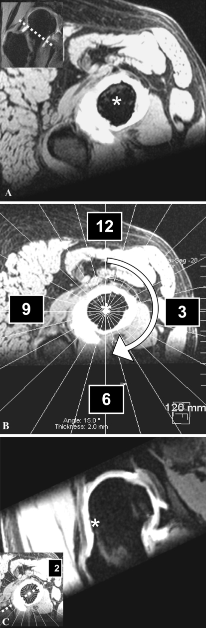 Fig. 1A–C