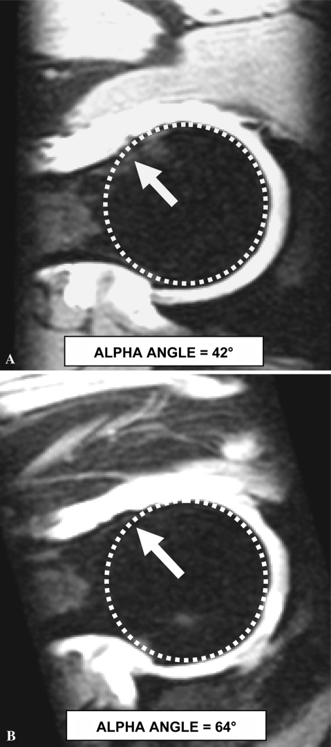 Fig. 3A–B