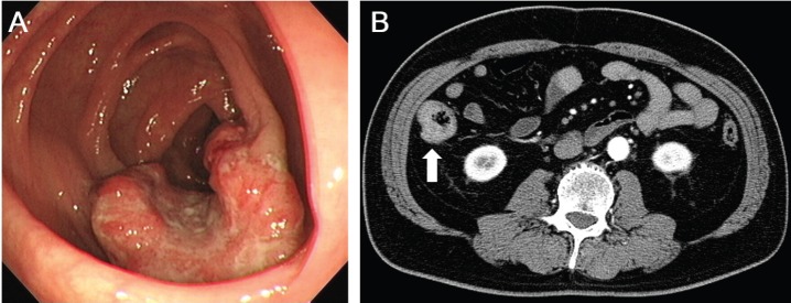 Figure 1.