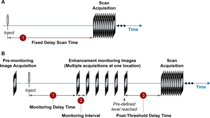 Contrast administration (A) fixed scan delay, (B) monitoring delay time, monitoring interval, post threshold delay time. Used with permission of Mayo Foundation for Medical Education and Research, all rights reserved.