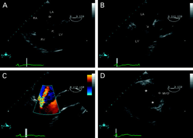 Figure 4  