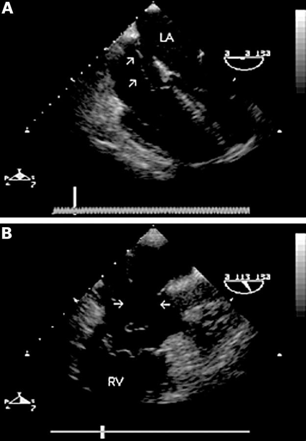 Figure 3  